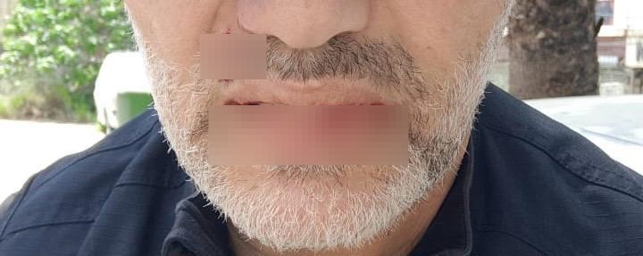 في قلب "الجبل"... شيخ سني يتعرّض للضرب أمام عائلته! (صور)
