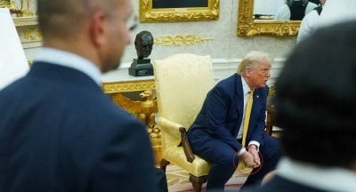 كدمة غامضة على يد ترامب تُثير التساؤلات... والمكياج لا يخفي القلق (صورة)