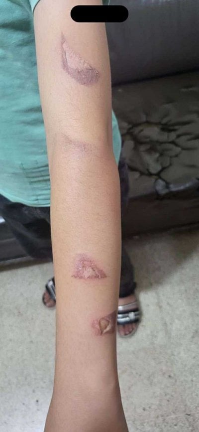 جريمة مروّعة في البقاع: أم تعنّف أطفال زوجها وتحرق ابنته بسكين… بتواطؤ من الزوج!