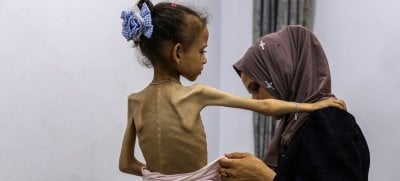 الجوع لا زال يحصد الأرواح في غزة... 7 وفيات جدد والكارثة تتفاقم