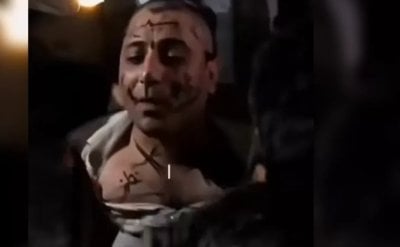 بعد الاعتداء على مطرب سوري في حلب.. الداخلية السورية في أول تعليق!
