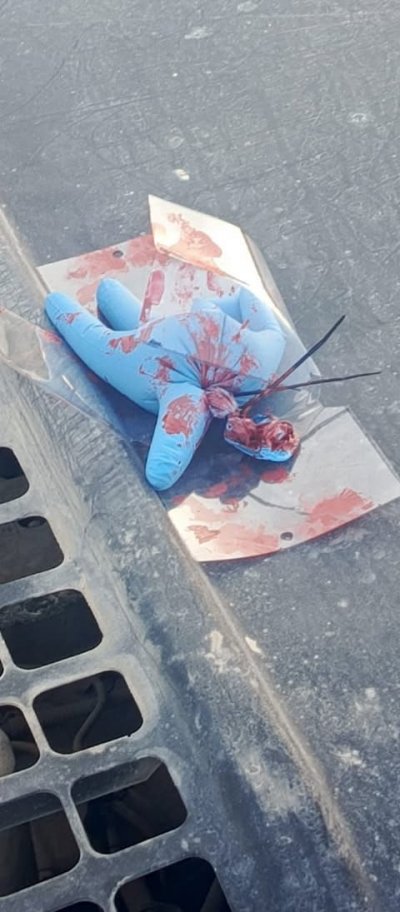 باسلوب تهديدي جديد... قفازات دم فوق ميس الجبل