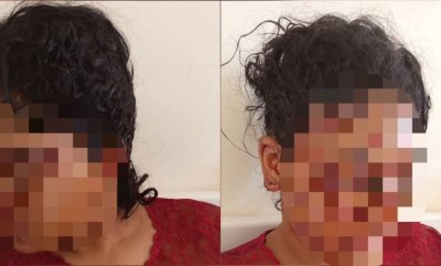 صدمة في المغرب... طليق يشوّه وجه زوجته السابقة