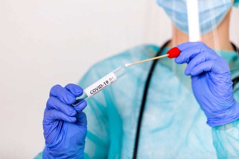 إنطلاق التحقيق ب "ملف الـPCR"... والجامعة اللبنانية تطالب بحصّتها من مليون فحص