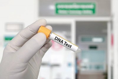 بعد 35 عاماً... اختبار DNA يكشف تبديل طفلين في النمسا