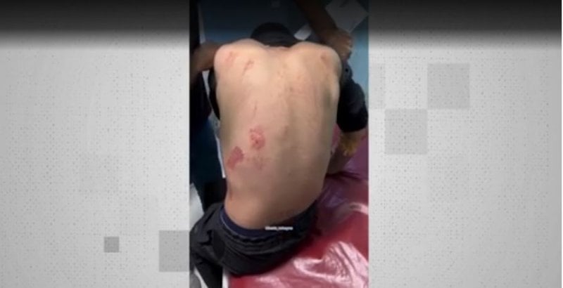 تفاصيل صادمة... مفرج عنهم من قبل إسرائيل يروون فصول التعذيب