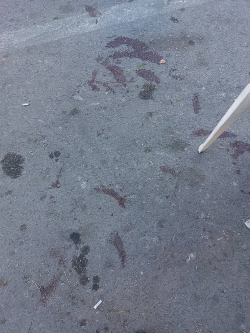 خلاف قديم يشعل الزرارية... والمقهى يتحوّل إلى ساحة إطلاق نار