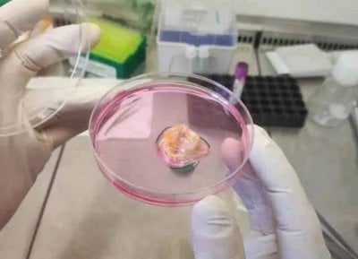 إنجاز في الطب المناعي... الإمارات تطلق علاجاً مبتكراً للسرطان