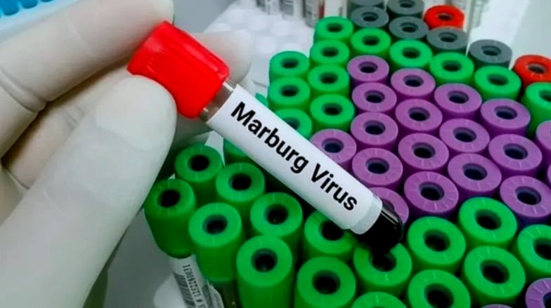 فيروس "قاتل" ينتشر عالميًا... لا علاج ولا لقاح: لبنان في دائرة الخطر؟!
