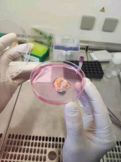 يفتح آفاق أمل جديدة للمرضى… مركز أبوظبي للخلايا الجذعية يطلق علاجًا مبتكرًا للسرطان