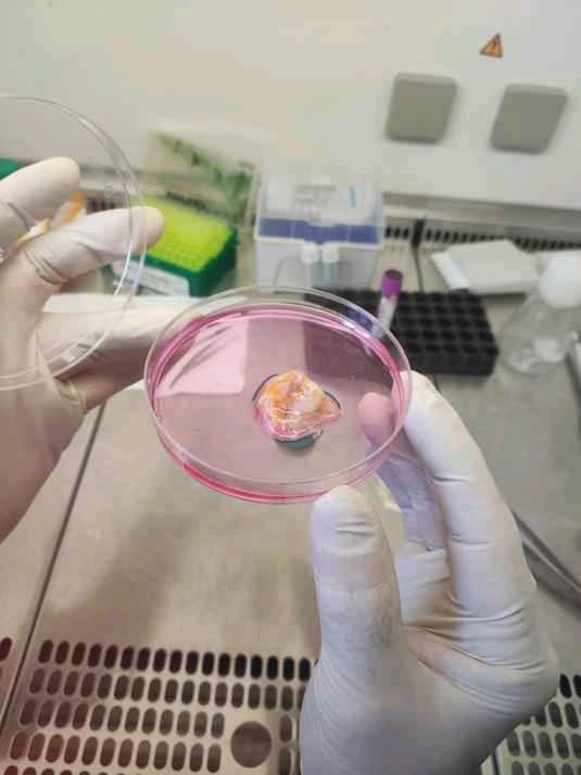 يفتح آفاق أمل جديدة للمرضى… مركز أبوظبي للخلايا الجذعية يطلق علاجًا مبتكرًا للسرطان