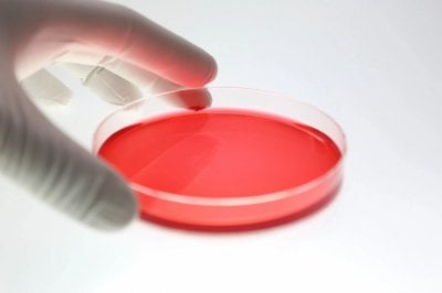 مبروك: ترياق السرطان دخل مستشفيات لبنان.. الى كل من يعاني من 