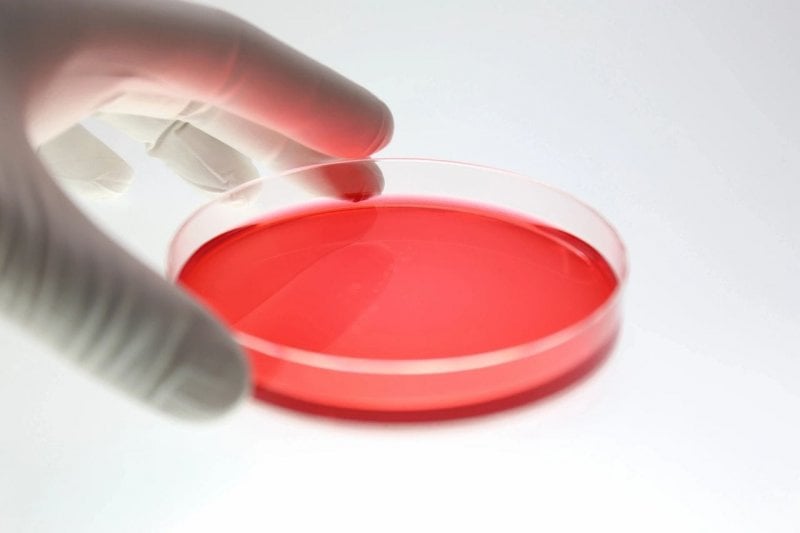 مبروك: ترياق السرطان دخل مستشفيات لبنان.. الى كل من يعاني من 