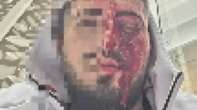 تداعيات حرب غزة مستمرة… اعتداء عنيف على إسرائيلي في قبرص