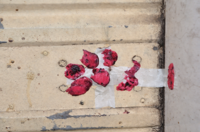 الشلل والموت مقابل السعر الأرخص… حين تتحوّل الحقنة إلى مغامرة قاتلة