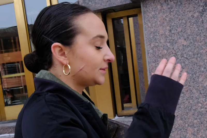 ندوب مروعة وعبارة "عاهرة ترامب"... تطورات صادمة في ملف ناتالي غرين