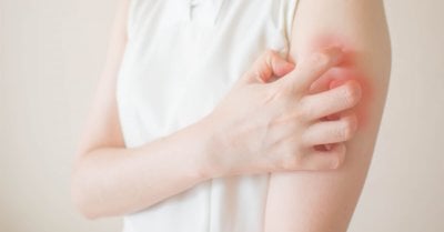 عدوى جديدة تثير المخاوف… والقلق يرافق ظهورها في لبنان: لا داعي للهلع!