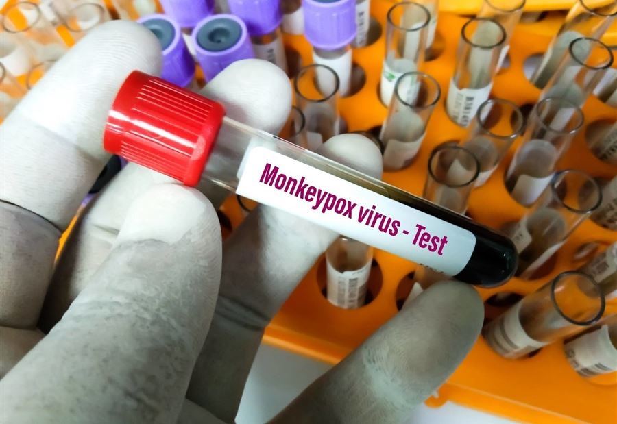"Mpox" يعود بسلالة أكثر خطورة... ودعوةٌ لتطبيق تدابير "صارمة" في المطار! "Mpox" يعود بسلالة أكثر خطورة... ودعوةٌ لتطبيق تدابير "صارمة" في المطار!