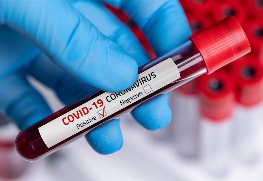 إصابة بـ"كورونا" في عدلون 