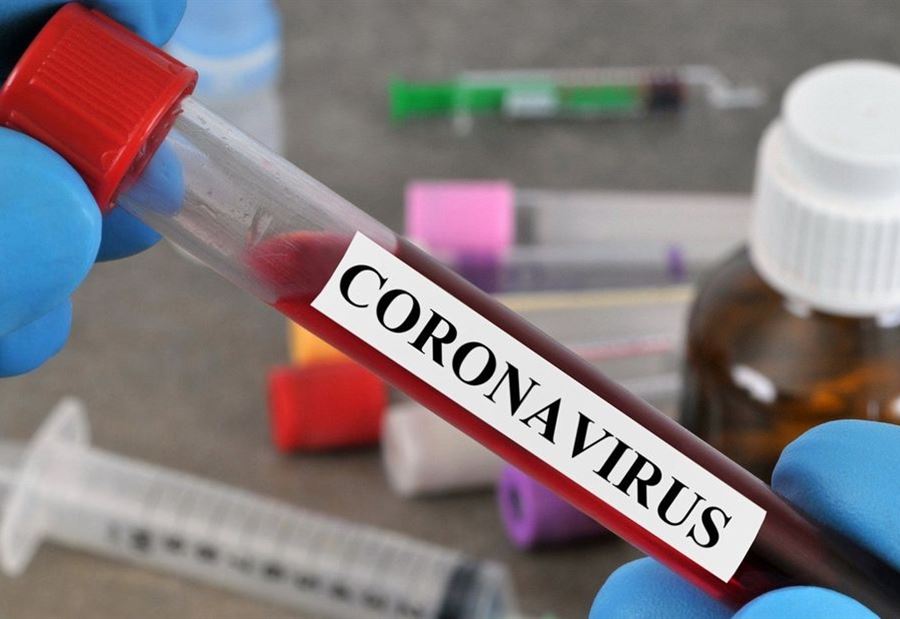 رشدبين: نتائج فحص الـ PCR لشخصين "إيجابية" رشدبين: نتائج فحص الـ PCR لشخصين "إيجابية"