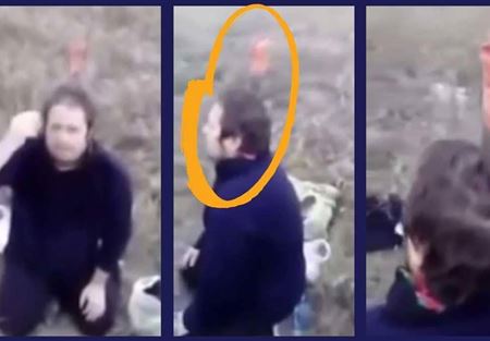 حماقة قاتلة.. غرس سكينا في رأسه لكي يتنفس