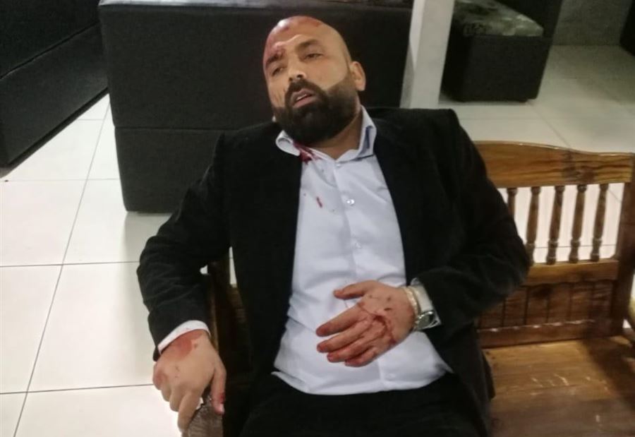 بالصور: مسلّحون يقتحمون مطعماً في الصفرا ويطلقون النار على شخصين