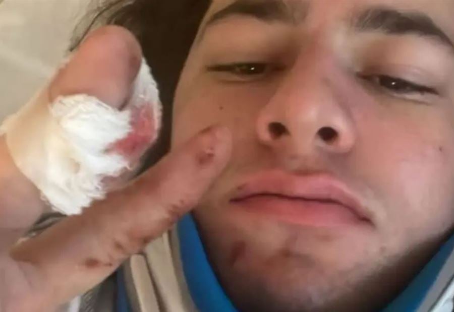 "واحد منهم قد لا يمشي مجدداً"... تفاصيل حالة شبّان "فيرمونت" الفلسطينيين