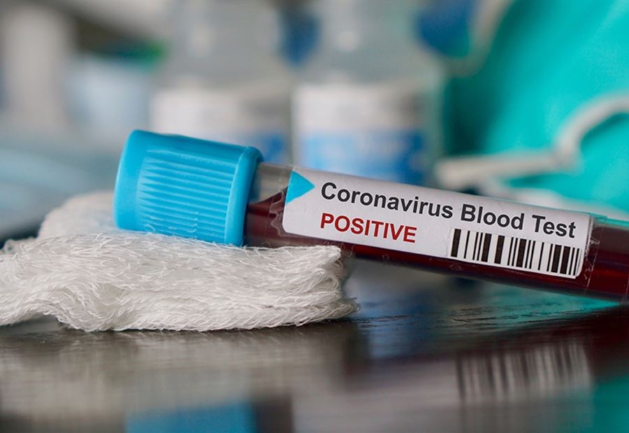 بلدية كفرحزير تدعو الأهالي إلى إجراء فحص "PCR"