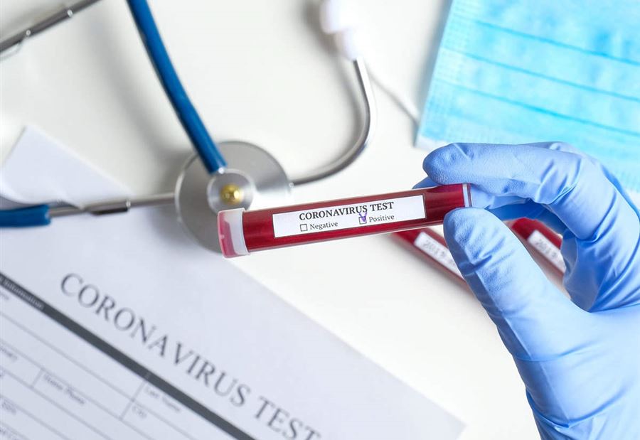 تسجيل 5 اصابات جديدة بـ كورونا في برجا