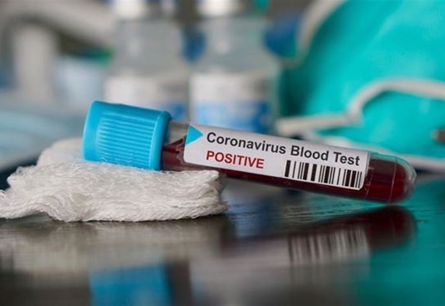 كورونا يخطف إعلامية لبنانية