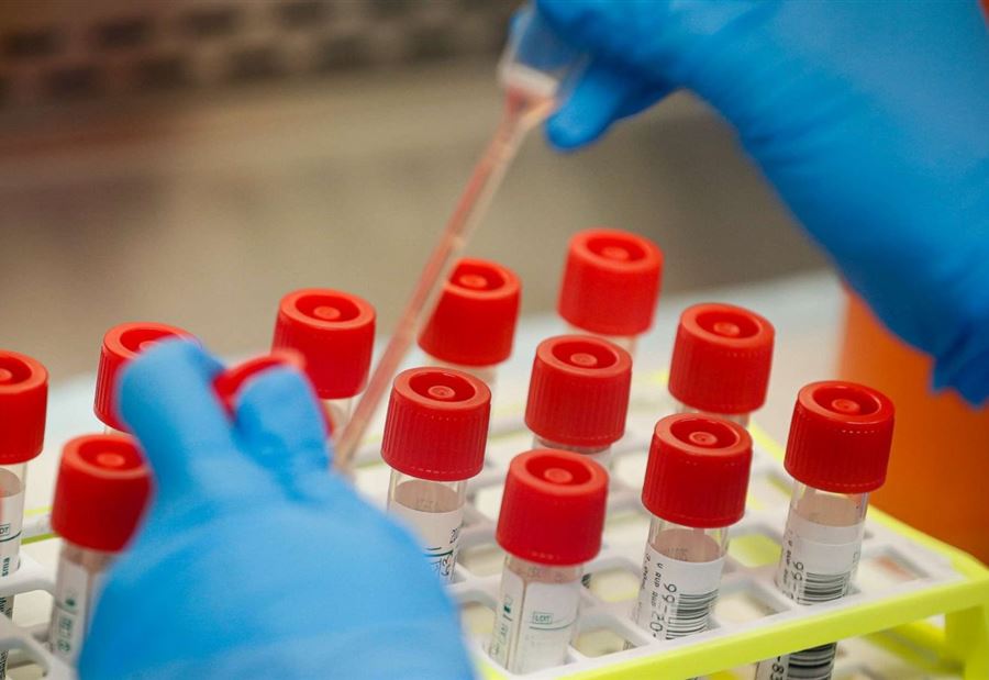 أعلى حصيلة يومية لإصابات كورونا في العالم  أعلى حصيلة يومية لإصابات كورونا في العالم