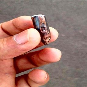 اصابة حرجة في بنين نتيجة إطلاق النار إبتهاجاً اصابة حرجة في بنين نتيجة إطلاق النار إبتهاجاً