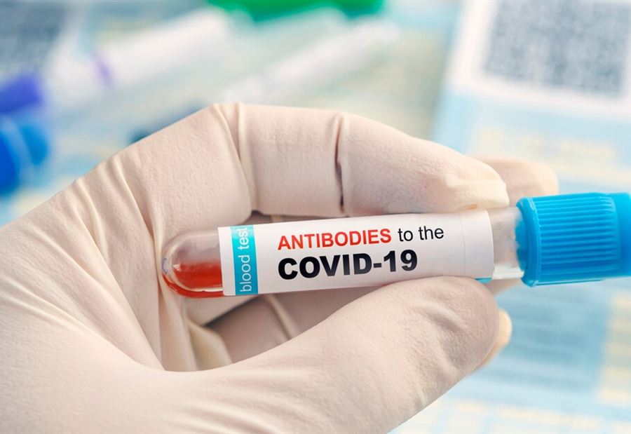 الرجال أم النساء... مَن الأكثر إنتاجاً لأجسام مُضادة لكورونا؟ الرجال أم النساء... مَن الأكثر إنتاجاً لأجسام مُضادة لكورونا؟