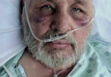 نجا من الموت بأعجوبة بعد كمين "النحل القاتل"