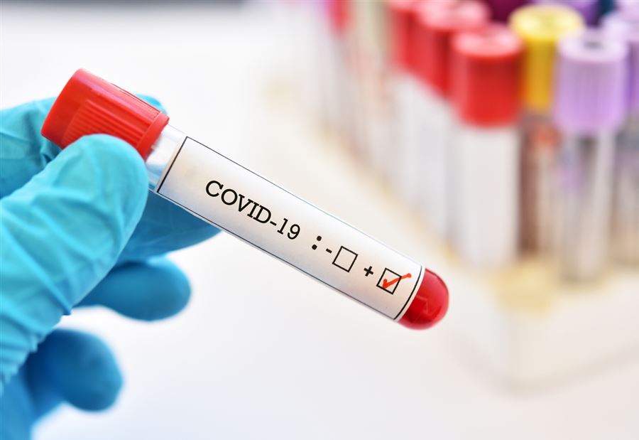 نتائج "كورونا" لرحلات إضافية وصلت إلى بيروت نتائج "كورونا" لرحلات إضافية وصلت إلى بيروت