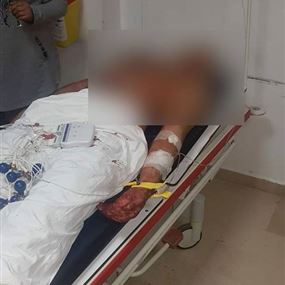 بالصورة: جندي في الجيش جريحاً... باشتباكات عائلية في بعلبك