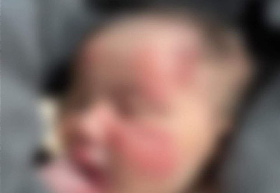 حادثة مؤلمة..."كلب يجرّ كيس أسود فيه رضيعة"