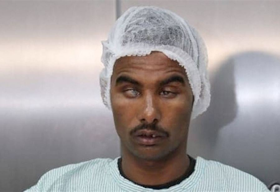 معجزة جديدة للطب: 3 أشقاء في مصر يبصرون بعد 30 عاما! 