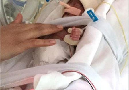 معجزة طبية.. ولادة طفلة لا يتجاوز وزنها النصف كيلو