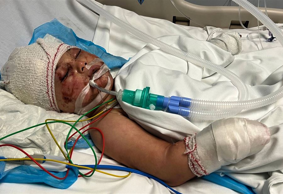 مأساة تحت الأنقاض: الطفل علي ينجو من غارة ويخسر عائلته كاملة مأساة تحت الأنقاض: الطفل علي ينجو من غارة ويخسر عائلته كاملة