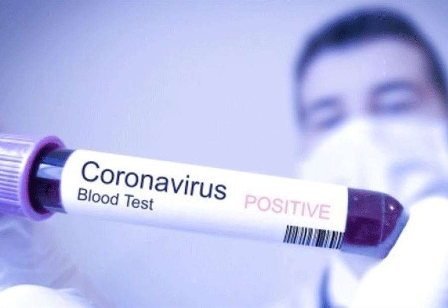 اتحاد بلديات إقليم التفاح يُعلِن نتائج فحوص الـ PCR