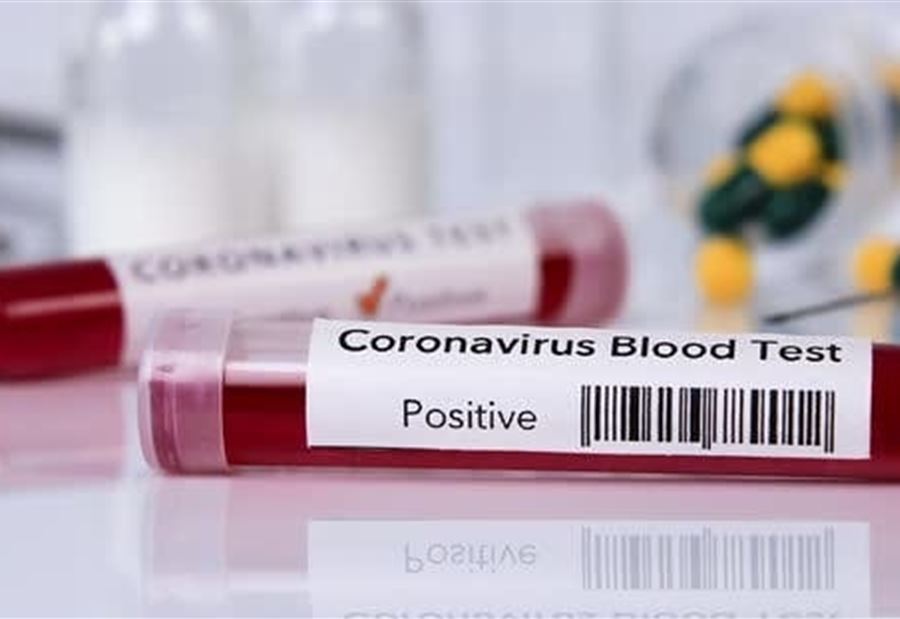 إصابةٌ بـ"كورونا" في المغيرية إصابةٌ بـ"كورونا" في المغيرية