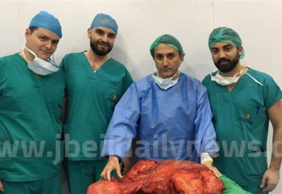 إنجاز طبي جديد في لبنان.. استئصال ورم وزنه 15 كيلوغراماً 