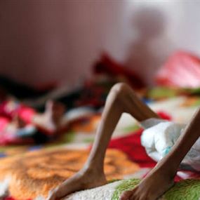 الأمم المتحدة تحذر من خطر مجاعة وشيكة في اليمن
