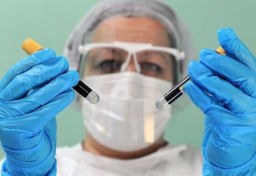 أداة تكشف عن الفيروسات الأكثر احتمالا لتَسبُّب الاوبئة  