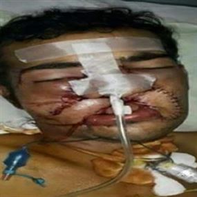 الحوثي بعد داعش في اختطاف الإعلاميين