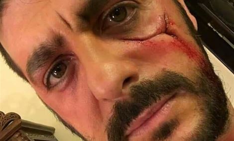 طوني عيسى: ما تسألوني كيف وليش! 
