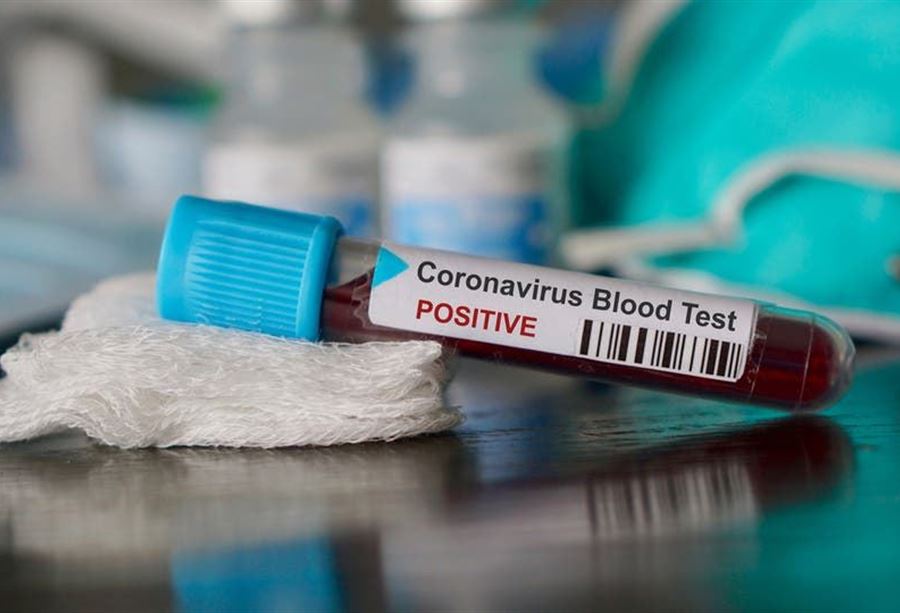 8 حالات وفاة جديدة بـكورونا في لبنان... ماذا عن الاصابات؟ 8 حالات وفاة جديدة بـكورونا في لبنان... ماذا عن الاصابات؟