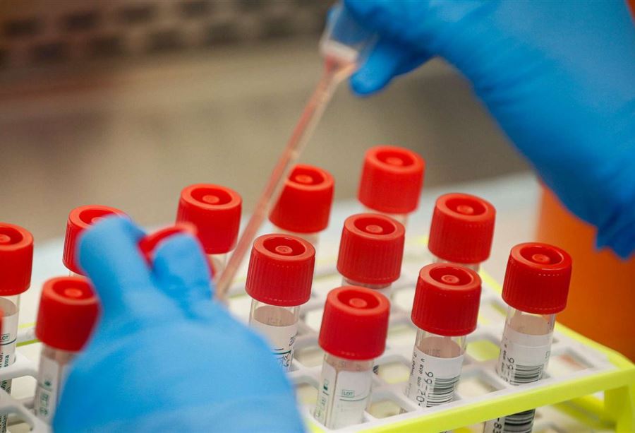 في حصرايل... وفاة أربعيني بكورونا في حصرايل... وفاة أربعيني بكورونا