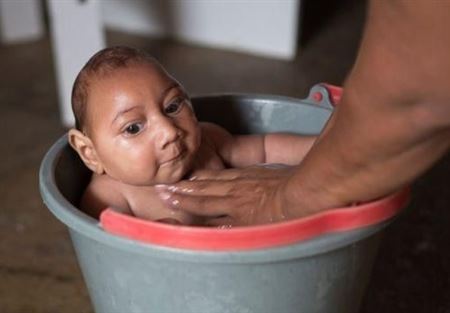 مكسيكية تحبط فيروس "زيكا" وتنجب طفلاً سليماً